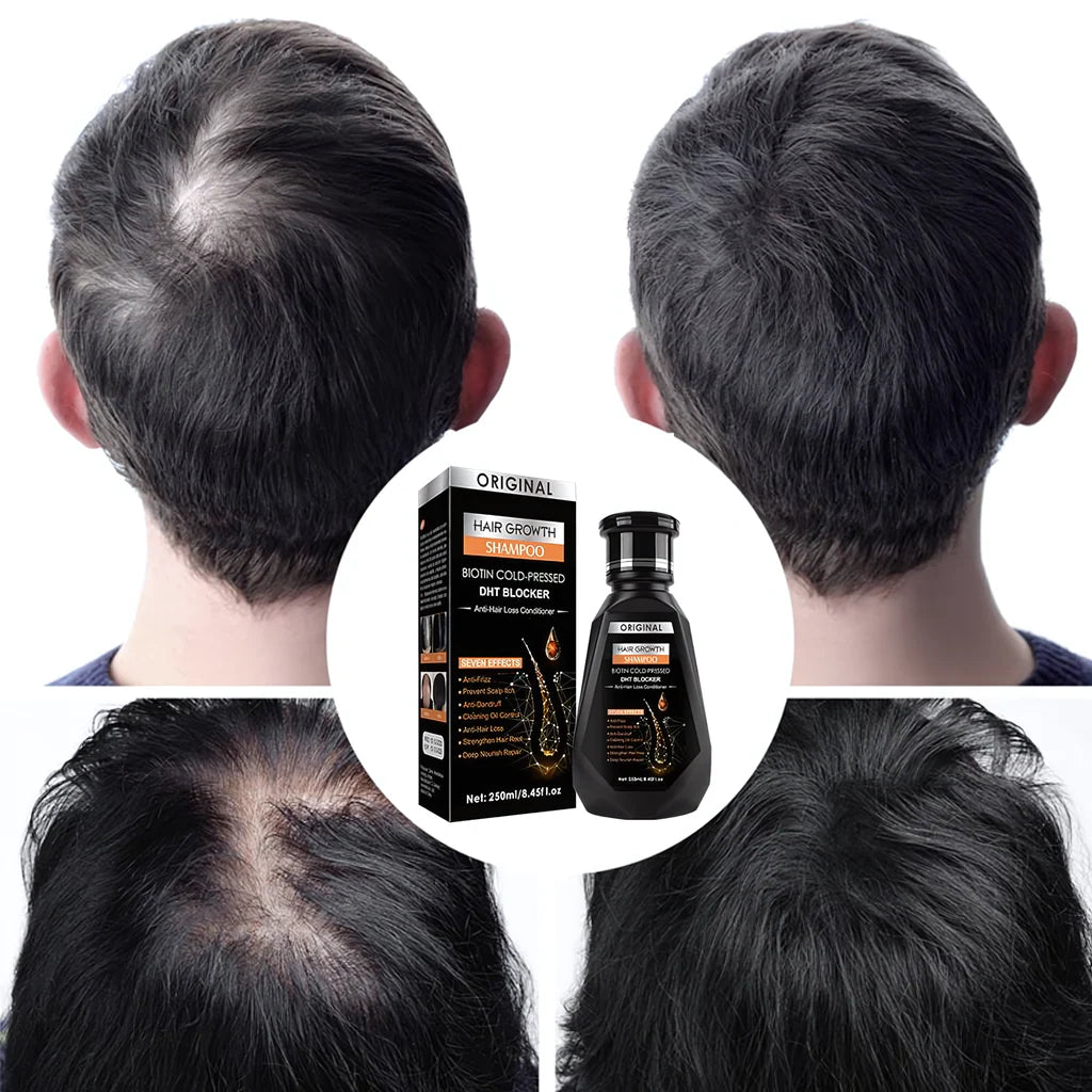 Original Biotin Cold-Pressed DHT BLOCKER Hair Growth Shampoo Formbo- 250ML