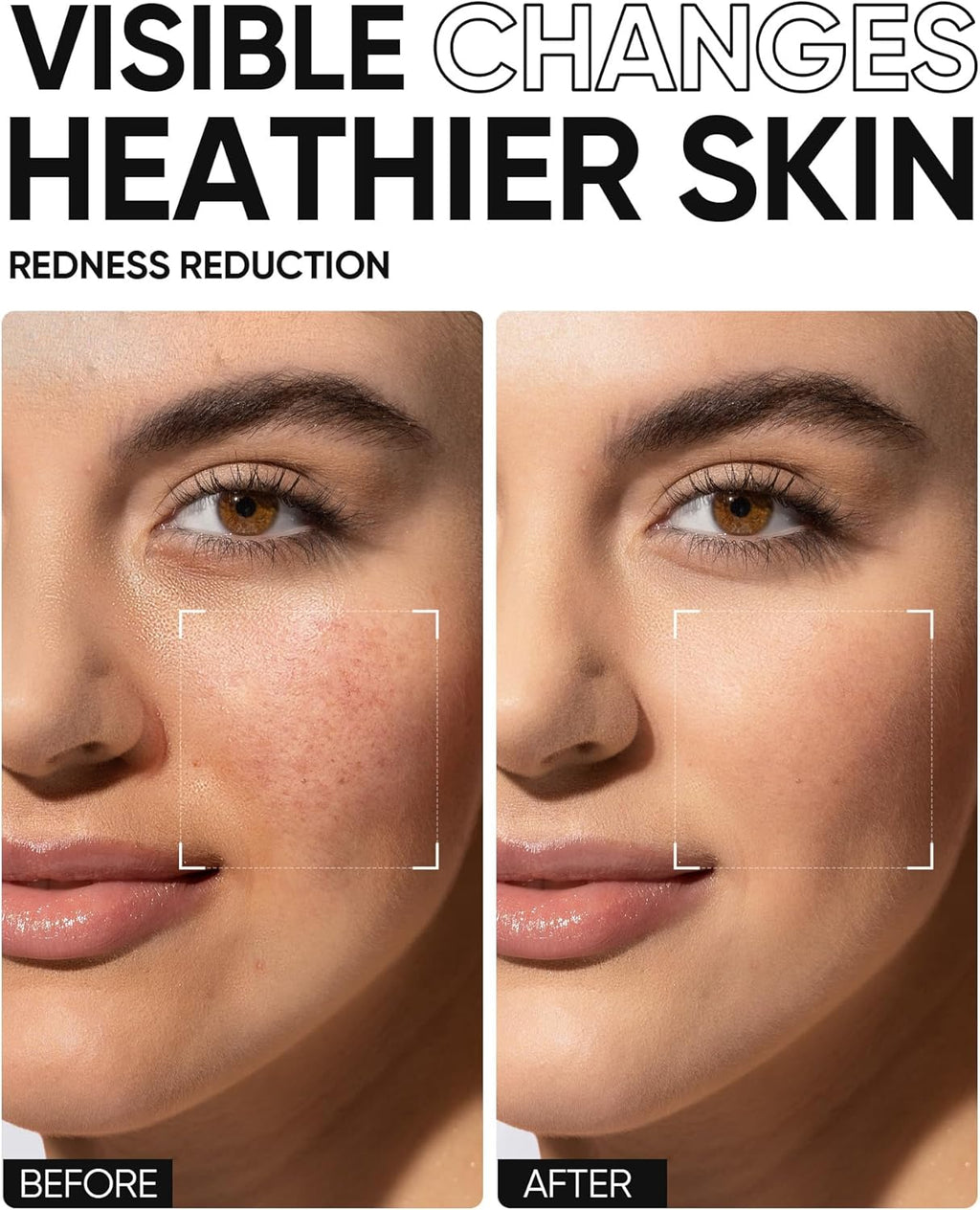 SKINTIFIC 5X Barrier Moisturizing Gel 30g