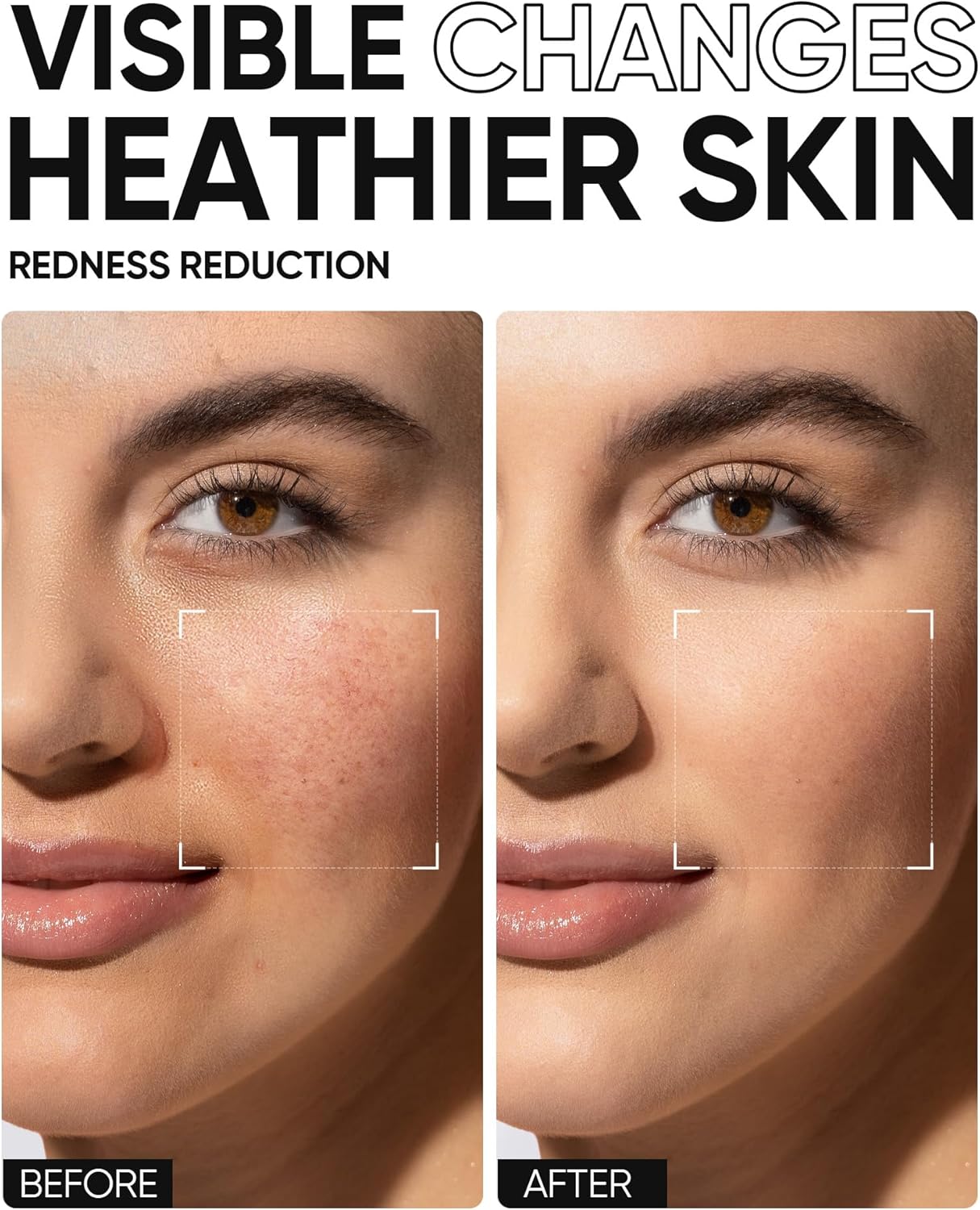 SKINTIFIC 5X Barrier Moisturizing Gel 30g