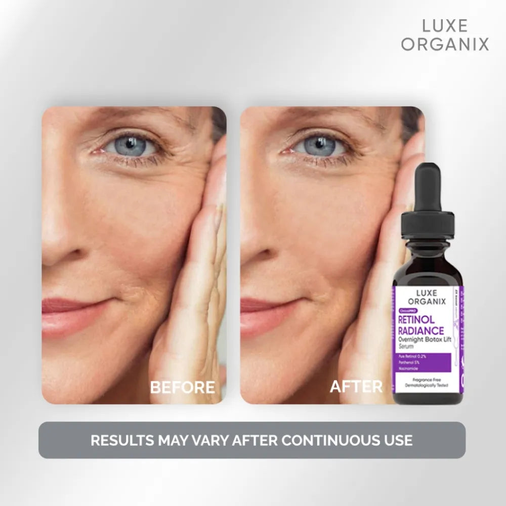 Luxe Organix Retinol Radiance Overnight Botox Lift Serum – 30ml
