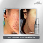 Luxe Organix Whitening Repair Ultra Light Glow Moisturizer – 80ml