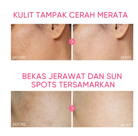 Skintific MSH Niacinamide Brightening Moisturizer Gel 30g