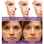 Venature Bakuchiol Retinol Rejuvenation Serum – 30ml