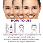 Venature Bakuchiol Retinol Rejuvenation Serum – 30ml