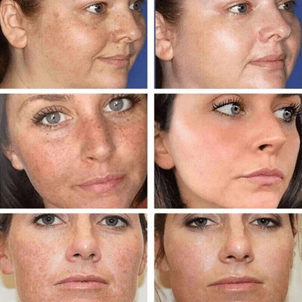 Dr Hancy White Spot Japan Cream - 20g