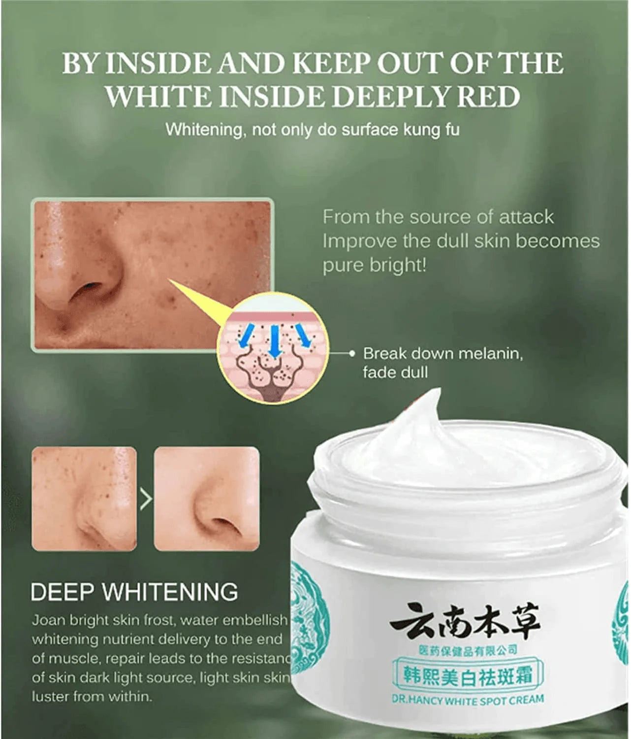Dr Hancy White Spot Japan Cream - 20g