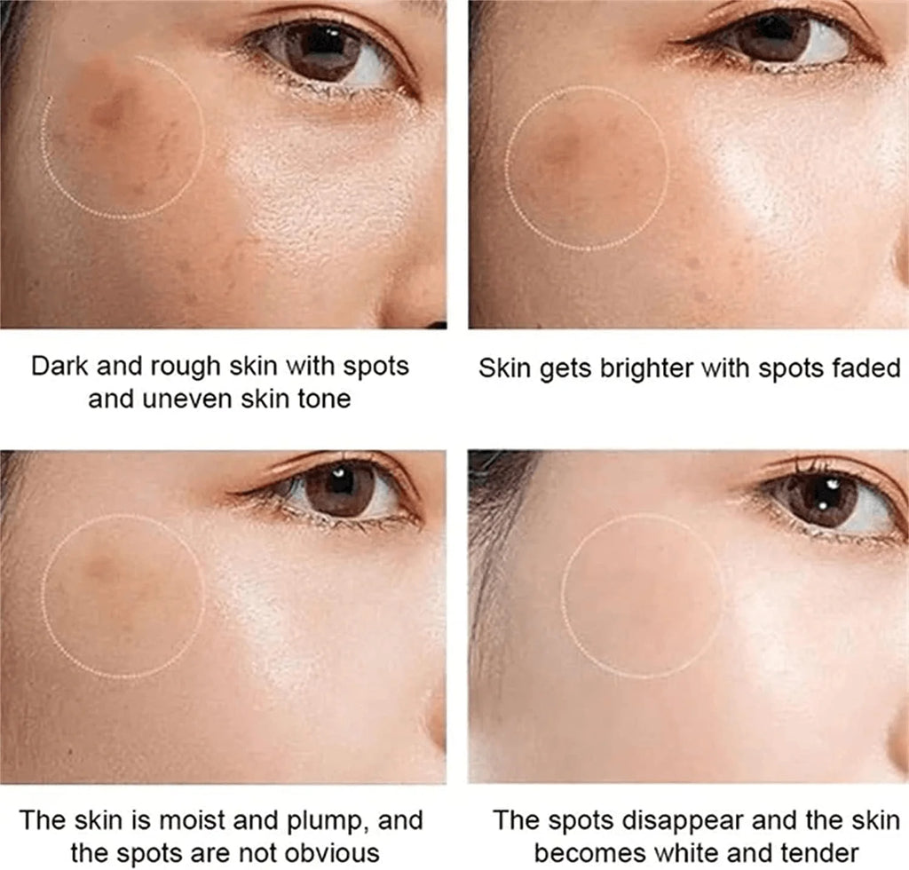 Dr Hancy White Spot Japan Cream - 20g