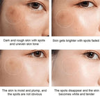 Dr Hancy White Spot Japan Cream - 20g